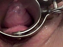 Cul 