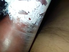 dilator und vakuumpumpe