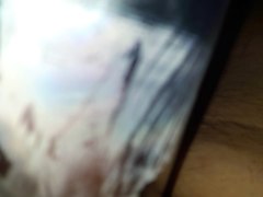 dilator und vakumpumpe